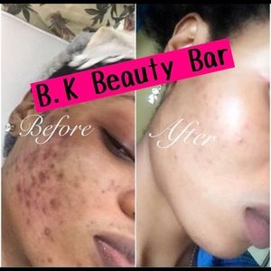 BK Flawless homemade organic skincare product.
